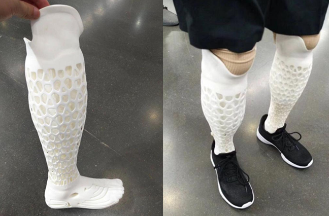 الأطراف الاصطناعية